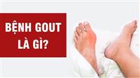 Bệnh Gút Có Mấy Giai Đoạn? Đặc Điểm Của Giai Đoạn Đầu Của Bệnh Gút?